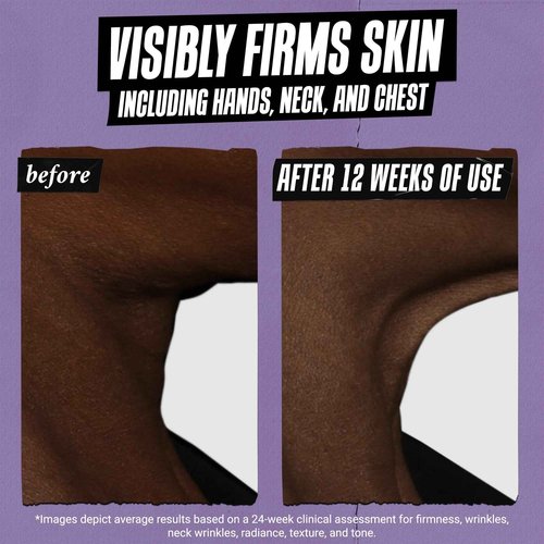Kiehl's Daily Micro-Dose Anti-Aging Retinol Facial Serum, Reduces Wrinkles, Firms Skin, Evens Skin Tone, Youth Renewing & Hydrating Formula, with Retinol & Ceramides, Paraben-free - 1.7 fl oz