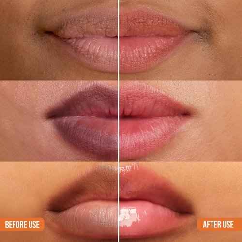 Combo Abera Saffron Serum For Melasma Treatment & Abera Dark Lip Corrector Cream, Lip Balm For Lightening & Brightening Dark Lip For Men & Woman