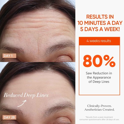 ESTANANA Cordless Red Light Therapy for Face, 7 Modes Led Face Mask Light Therapy with Remote, Near Infrared 880 Red Light Therapy Mask at Home, Wrinkle Reduction, Anti-Ageing, Black