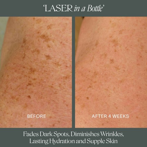 Doctor Rogers Body Repair Treatment Serum, 5 Ounce (150 ml)