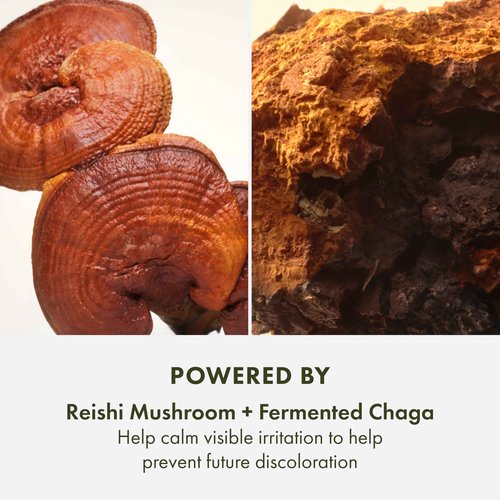 Origins Mega-Mushroom Dark Spot Serum | Reduces Visible Hyperpigmentation & Post-Acne Marks | With Vitamin C & Reishi Mushroom, 1 Fl Oz