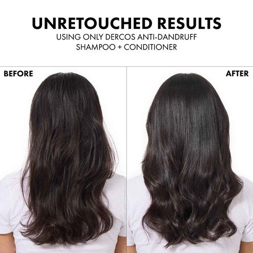 Dercos Selenium Sulfide Anti Dandruff Shampoo + Hair & Scalp Moisturizing Conditioner + Salicylic Acid Anti-Dandruff Serum, Eliminates Flakes & Fights Recurring Dandruff & Itchy Scalp