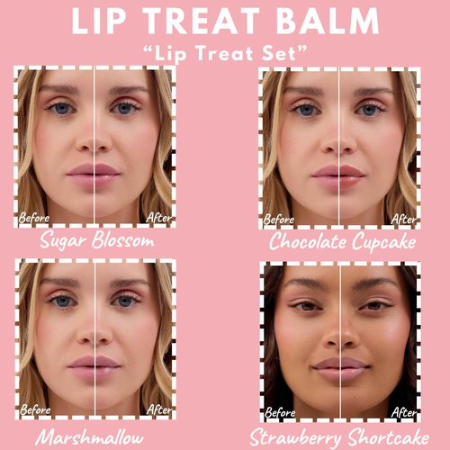 Crickle Daisy Lip Treat Balm - Hydrating & Nourishing Lip Balm with Avocado, Olive, and Coconut Oils - Softening Lip Moisturizer & Protection for Very Dry Lips - Set Of 4, 0.7oz Each