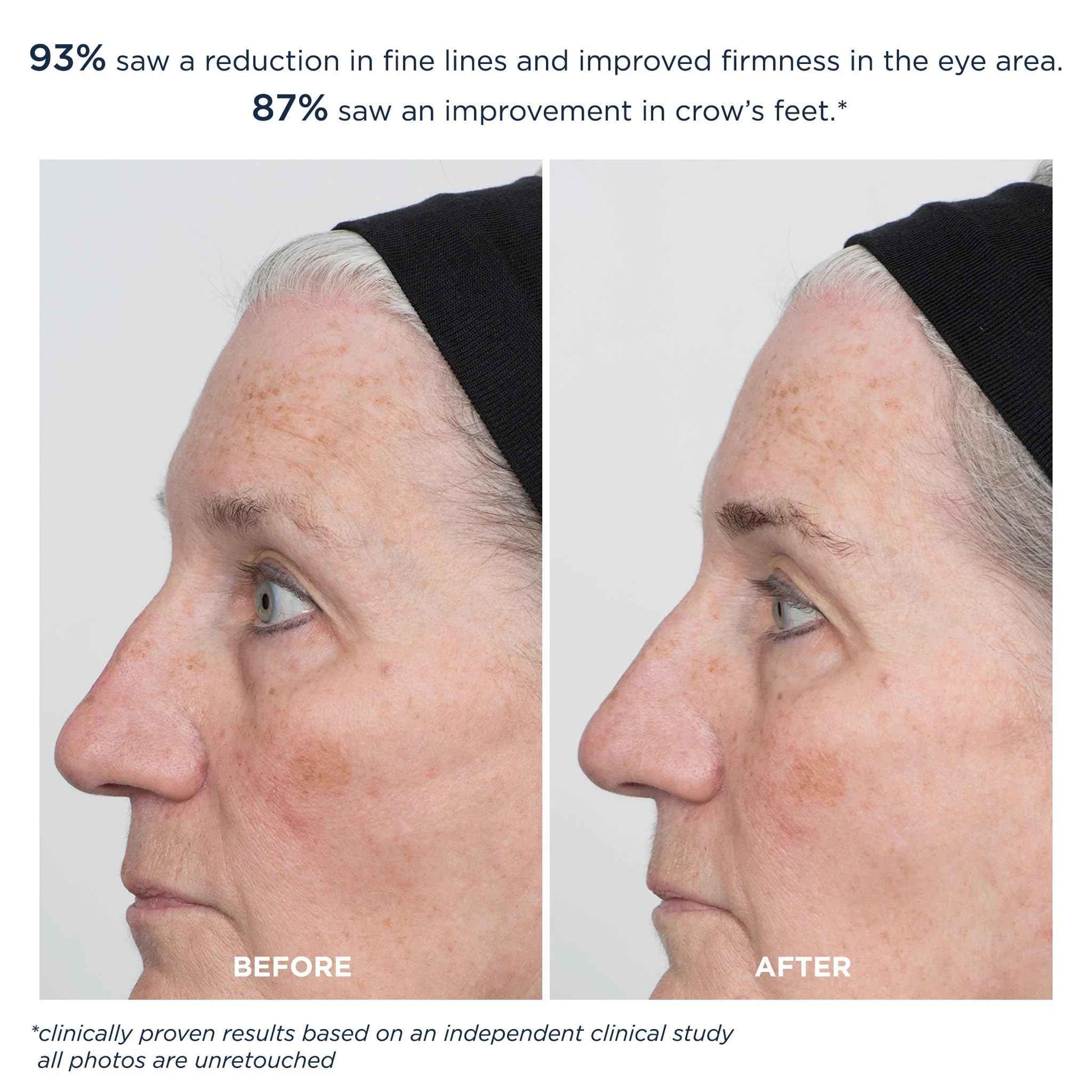 m-61 ProSmooth Retinol Eye Serum | 0.1% Non-Irritating Retinol Eye Serum with Vitamin C, 0.5 Fl Oz