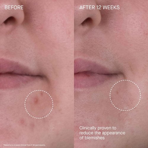 Augustinus Bader The Rich Cream – Luxury Face Cream – Hydrating and Nourishing Face Moisturizer – Facial Moisturizer for Wrinkle Reduction and Cellular Renewal – For Men and Women – 0.5 fl oz