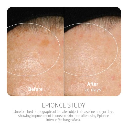Epionce Intense Recharge Mask - Anti-Aging Clay Face Mask for All Skin Types, Hydrating Mask with Kaolin for the Skin Barrier, Dermatologist Skincare