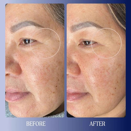 Kinship Dream Wave 2% Bio-Retinoid Overnight Ultra Hydrating Serum for Face | Retinol for Sensitive Skin | Anti Aging Niacinamide + Tranexamic Acid | Smooth Wrinkles | Redness Reducing Skin Care 1 Oz