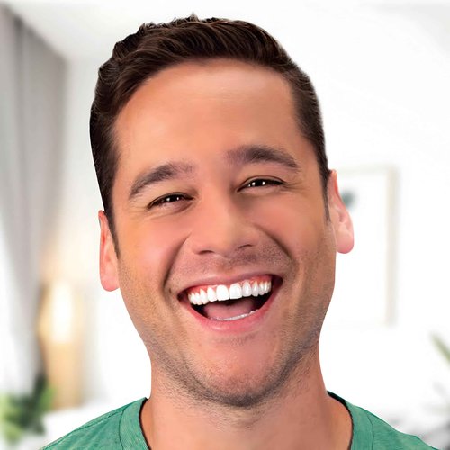 Opalescence 35% (12 Syringes) Teeth Whitening Refill Kit Carbamide Peroxide. Made by Ultradent Tooth Whitening Refill Syringes A-5197-6