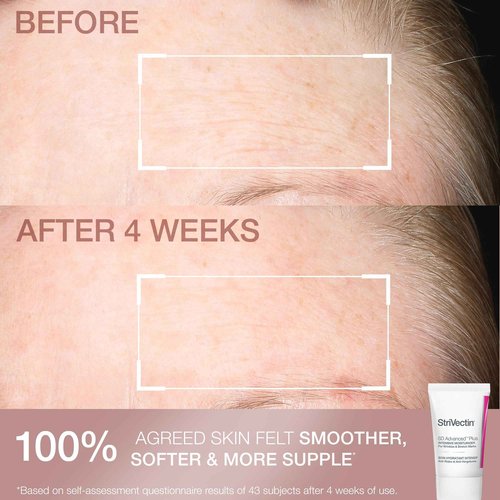 StriVectin Smooth & Hydrate Face Moisturizer and Eye Cream Skin Care 2-Piece Set