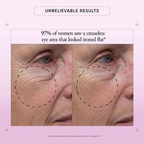 philosophy ultimate miracle worker power treatment fill & firm eye cream- with retinol & soy extract - creates a notably smoother and more youthful-looking appearance -0.5 fl oz