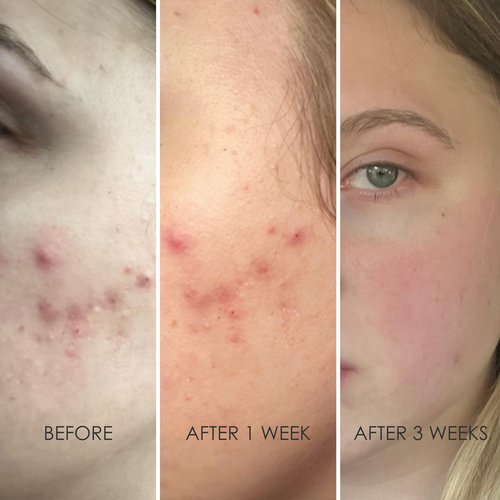 REFLEKT 2 Collagen Boost Vitamin C Serum