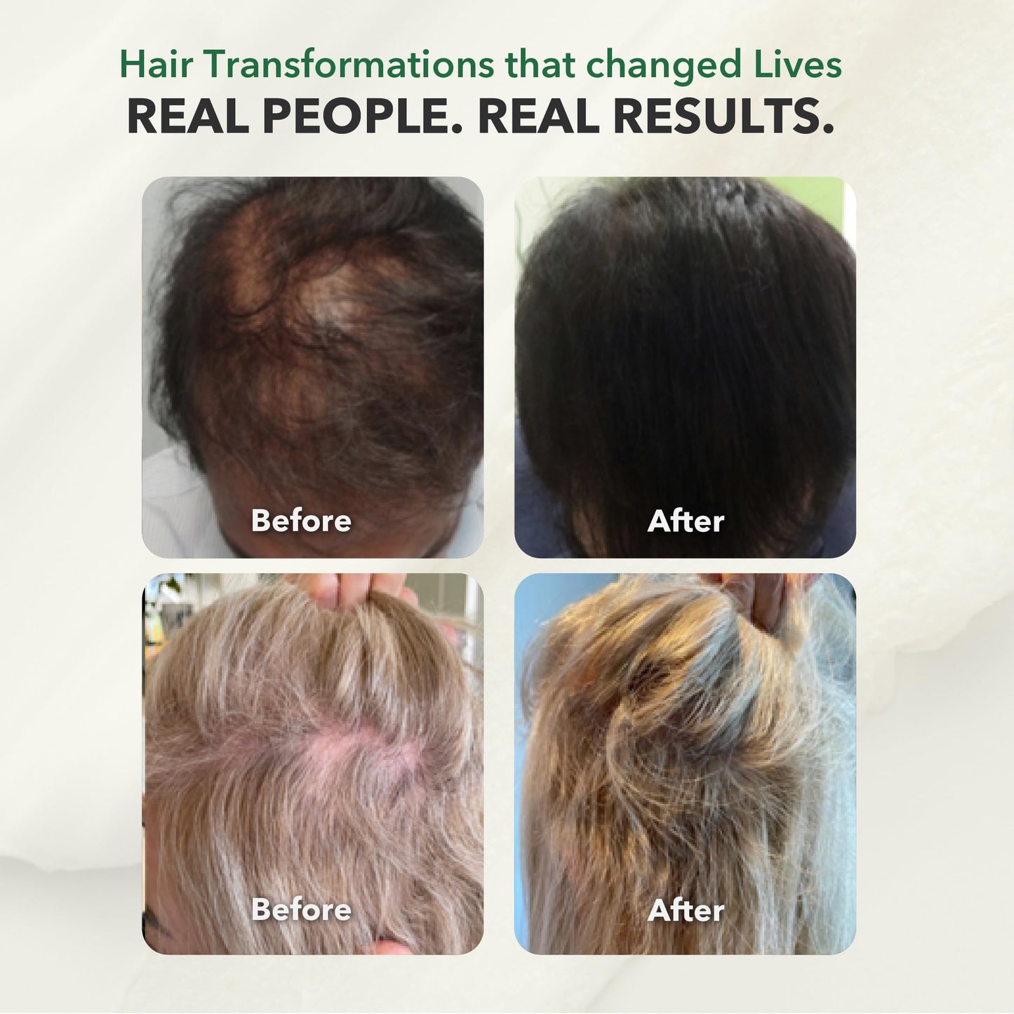 HairSmart Hair Growth Shampoo and Conditioner | Paraben & Sulfate Free with Ayurvedic Herbs | Hair Loss Treatments for Women and Men | Volumizing Shampoo and Conditioner, Pack of 2, 100ml Each