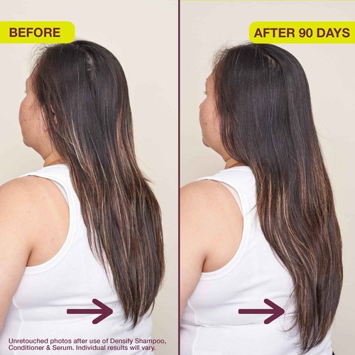 Densifying & Thickening Serum for Thinning Hair, 1oz