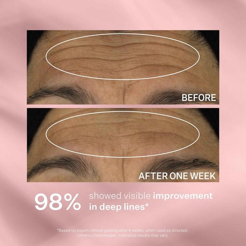 StriVectin Wrinkle Recode Line Transforming Melting Serum, 1 Fl Oz