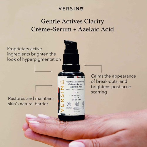 Versine Gentle Actives Serum for Face | Acne Prone Skin | Pregnancy Safe with Azelaic Acid, Vitamin C, Squalane, Niacinamide, Hyaluronic Acid | Moisturizer, Anti Aging and Brightening | 1Fl Oz