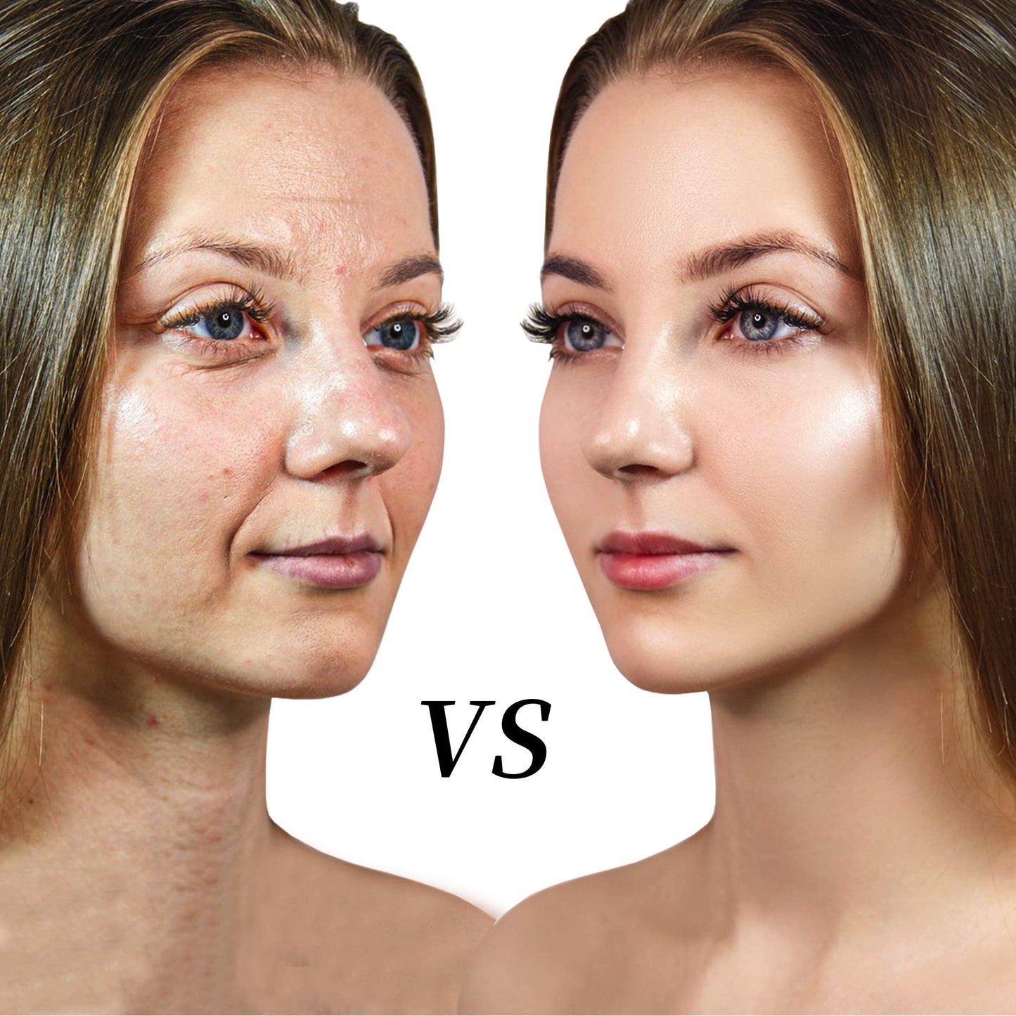 HYPOD Pdo Multi Thread Can Be Dispersed Into Several Extremely Thin PDO Threads 16 PCS (23G38MM)