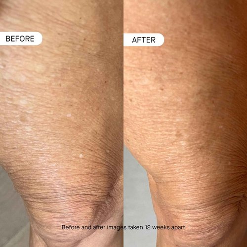 OneSkin BODY OS-01 Peptide Skin Longevity Daily Moisturizer- Improves Skin Texture & Barrier, Safe for Sensitive Skin, 250 mL/ 8.45 fl oz