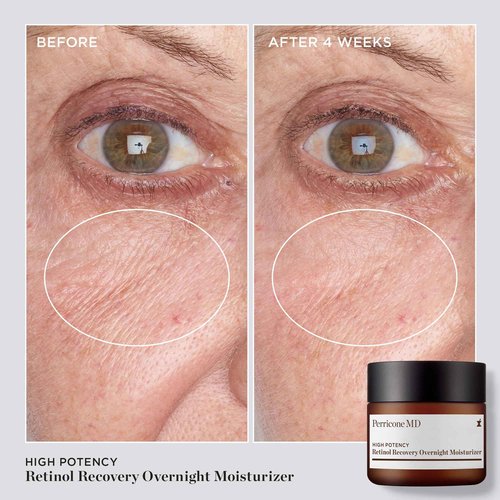 Perricone MD High Potency Retinol Recovery Overnight Moisturizer, 2 fl. oz.