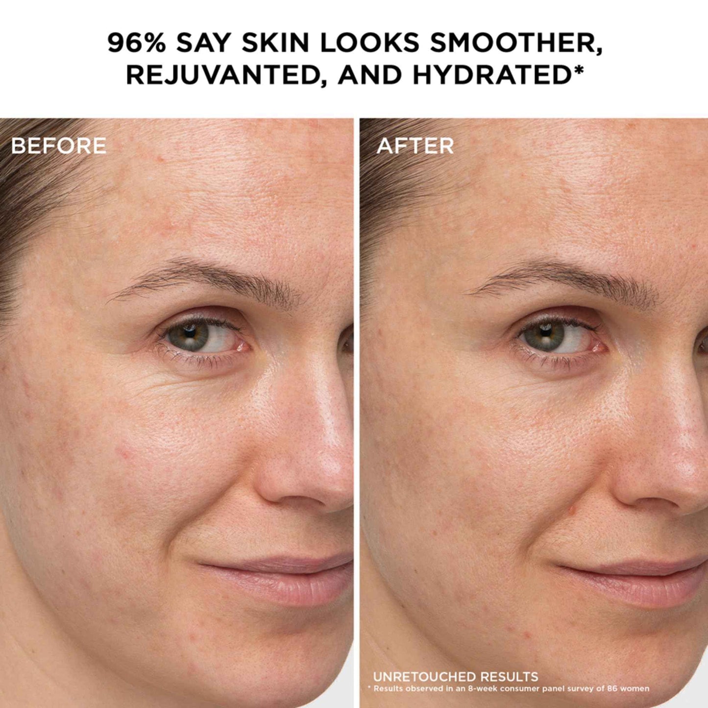 IT Cosmetics Confidence in a Cream Jumbo - Hydrating & Anti Aging Face Moisturizer, Visibly Reduces Fine Lines & Wrinkles, Up To 48H Hydration, Repairs Skin Barrier, Squalane & Ceramides - 4 fl oz