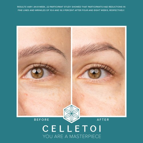 Celletoi® Restorative Eye Treatment - Vegan, Cruelty Free - Visibly Reduces Signs of Aging, Smooths Lines and Wrinkles - Diminishes Dark Circles and Puffiness - Leaping Bunny Certified - 0.5 fl oz