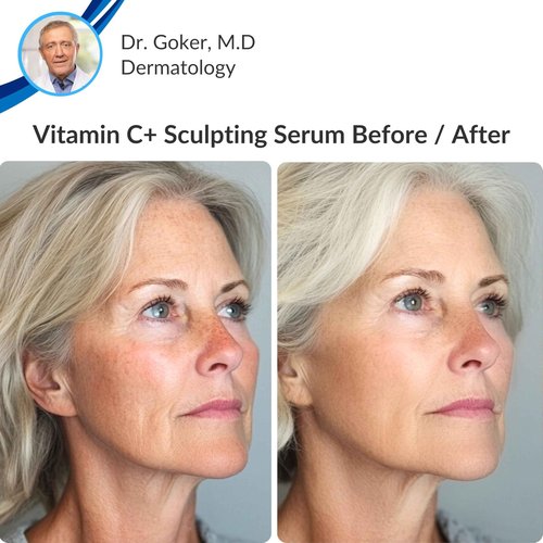 LeVaye Vitamin C Serum, Anti-Aging Face Serum – 15% Vitamin C, Ferulic Acid, Niacinamide, Hyaluronic Acid, Peptides, Ceramides – Targets Wrinkles, Fine Lines, Dark Spots, Enlarged Pores, Dry Skin