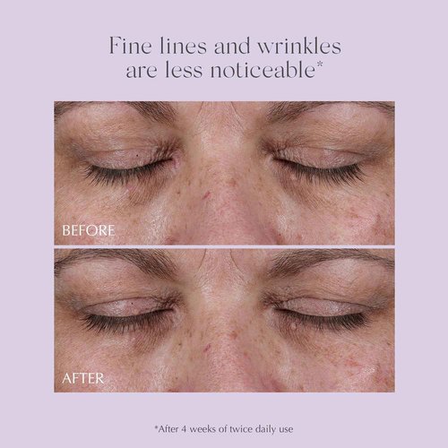 EXUVIANCE AGE REVERSE+ Total 360 Eye Contour, Anti-Aging Eye Cream, Brightens Dark Circles, Firms and Tightens Fine Lines and Wrinkles, with Caffeine, Hyaluronic Acid, and Peptides, 15g