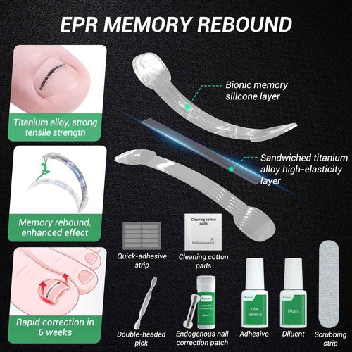 Reieset Titanium Alloy Ingrown Toenail Treatment, Nail Tools, and Ingrown Toenail Removal Kit Specially Designed for Curved Nail Repair and Ingrown Toenail Corrector (0.67/0.79in)