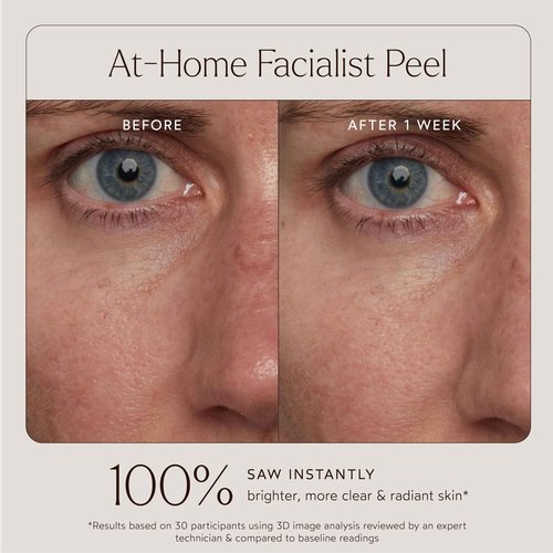 True Botanicals At-Home Facialist Peel Face Mask | Natural Exfoliating Treatment for Smooth, Radiant, Hydrated Skin | Dermatologist Tested, All Natural, Vegan, Clinically Proven | 1 fl oz | 30 ml