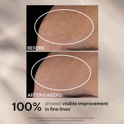StriVectin Advanced Retinol Nightly Multi-Correct Serum