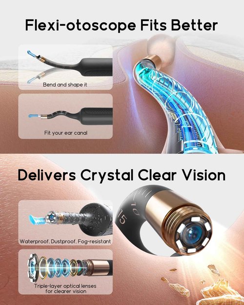 Bebird Earsight Plus R37R Ear Cleaning Camera Wax Removal Tool kit, Flexible Ear Scope Otoscope Camera Light, Visual Ear Picker Wireless Earwax Remover Tweezers for Family