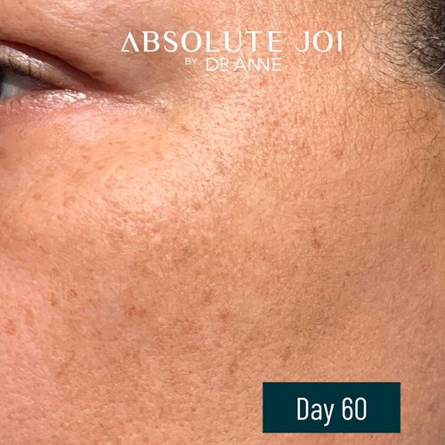 Retinol Oil Serum with Vitamin C, Skin Refining Night Oil for Fine Lines and Hyperpigmentation with Sensitive Skin Friendly Granactive Retinoid - Unscented - 1 Fl Oz Full Size