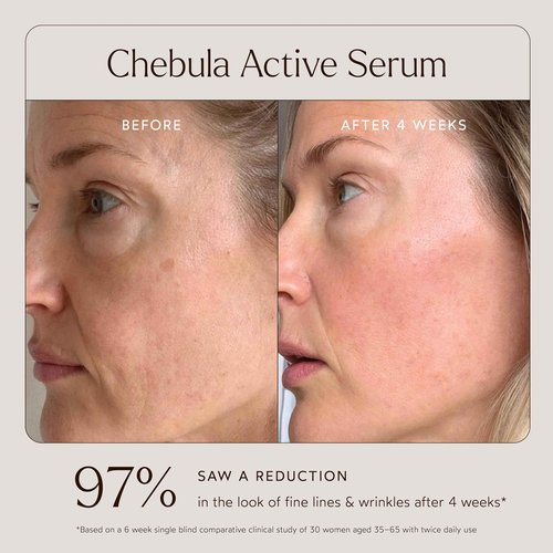 True Botanicals Tried & True Wellness Essentials Bundle | Ginger Turmeric Cleansing Balm | Chebula Active Serum | Pure Radiance Oil | Phyto-Retinol Advanced Clinical Cream | Glossy Lip Balm