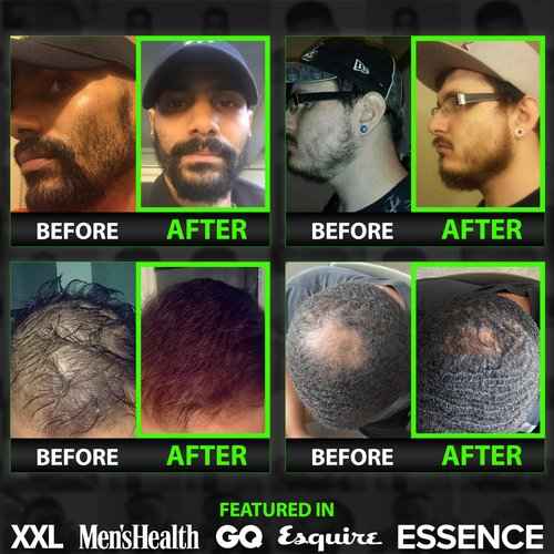 Beard Growth Kit w/ 100% Lifetime Replacement Boar Bristle Brush + GROW 11-in-1 Mens Shampoo & Conditioner (Hair Growth Shampoo for Men w/Biotin) + GROW XXL Beard Oil for Men (Made in America)