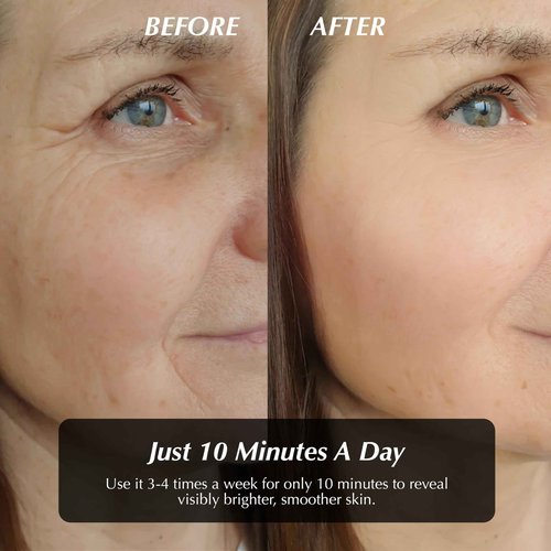 Vital Glow Red Light Therapy Mask, LED light Therapy for Face + Jade Roller & Gua Sha, At-Home Skincare Beauty Treatment, For Home, Portable & Rechargeable