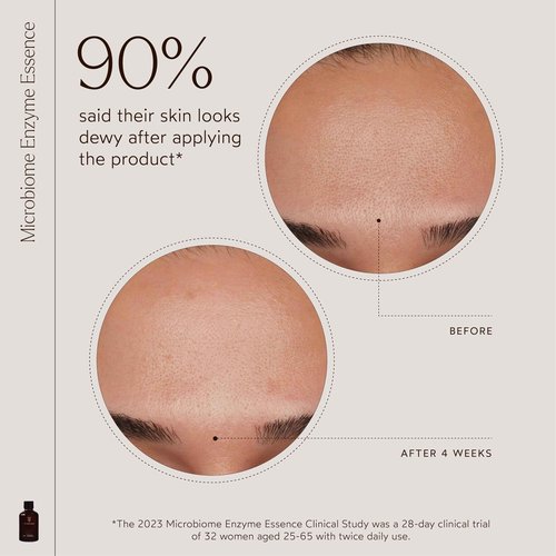 True Botanicals Microbiome Enzyme Essence | Hydrating & Resurfacing Benefits for All Skin Types | Gives a Dewy Looking Complexion | Dermatologist Tested, All Natural, Vegan | 4 fl oz | 118 ml