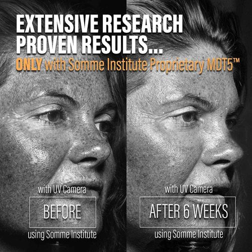 Anti-Aging Vitamin C Serum with MDT5™ | Brightening Facial Serum | Somme Institute Skincare for Even Skin Tone | Collagen Production, Remove Fine Lines, Wrinkles, Hyperpigmentation | 1 Fl Oz