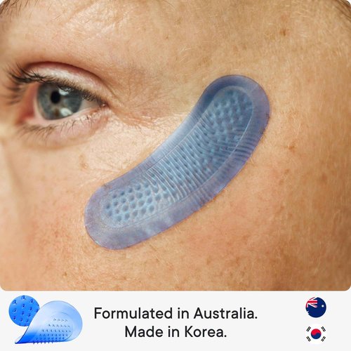 Qure Micro-Infusion Anti Wrinkle Patches for Smile Line, Frown lines, Under Eye Bags, Puffiness, Crow's Feet - Retinol, Caffeine, Peptides - Dissolvable for Overnight Use - 8 Pairs