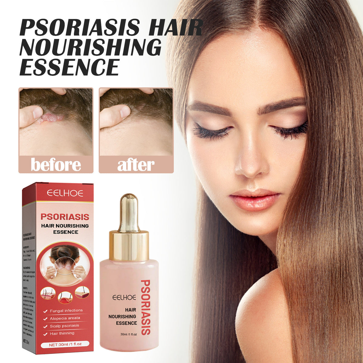 Scalp Cleansing Serum 30ml - Oil Control & Flake-Free