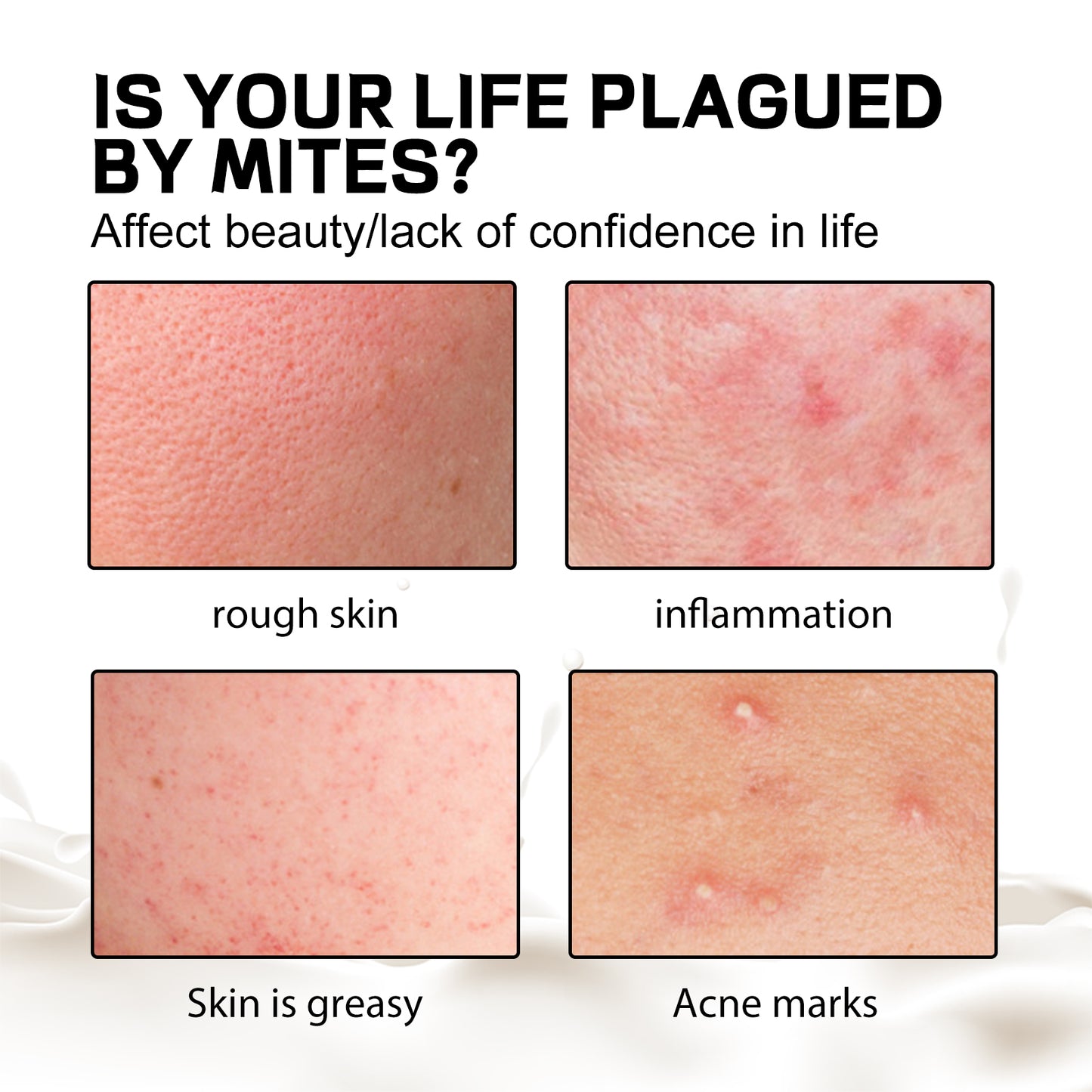 Aurora Purifying Mite-Removing Soap - Deep Cleansing Tea Tree Oil Bar
