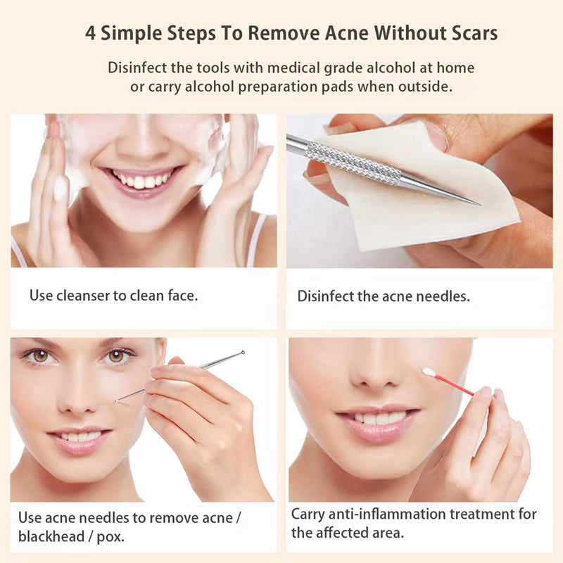 5-Piece Stainless Steel Blackhead Extractor and Acne Removal Tool Kit