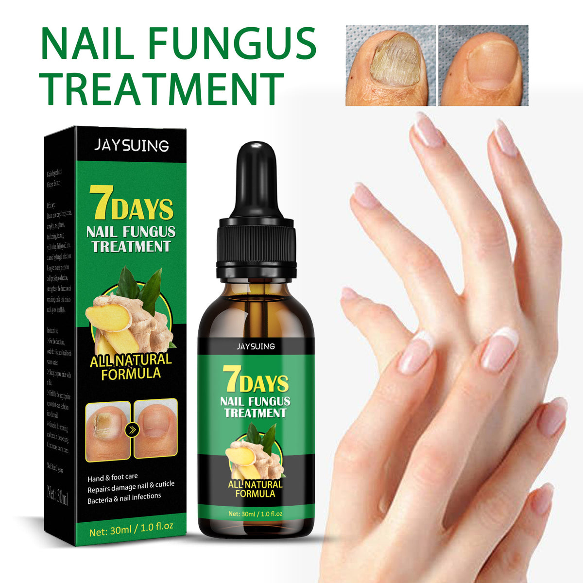 Ginger Nail Repair Lotion - Hand & Foot Moisturizing, 30ml
