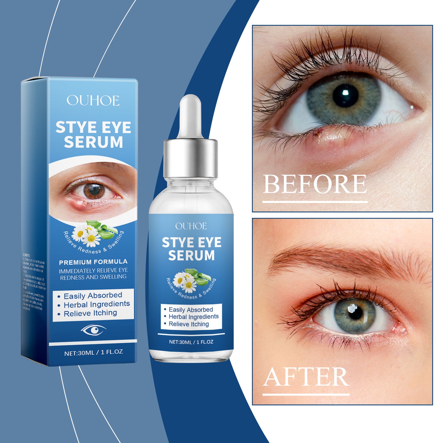 Moisturizing Eye Care Drops - Daily Relief for Dry Eyes with Aloe Vera