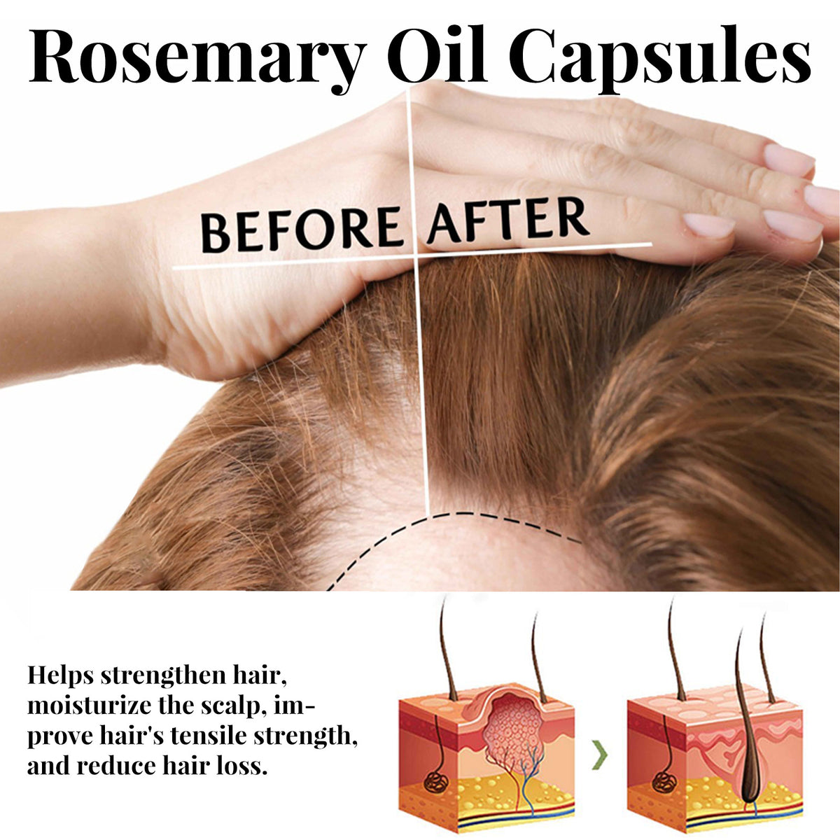 Rosemary Hair Care Capsules Nourish Roots And Prevent Loss