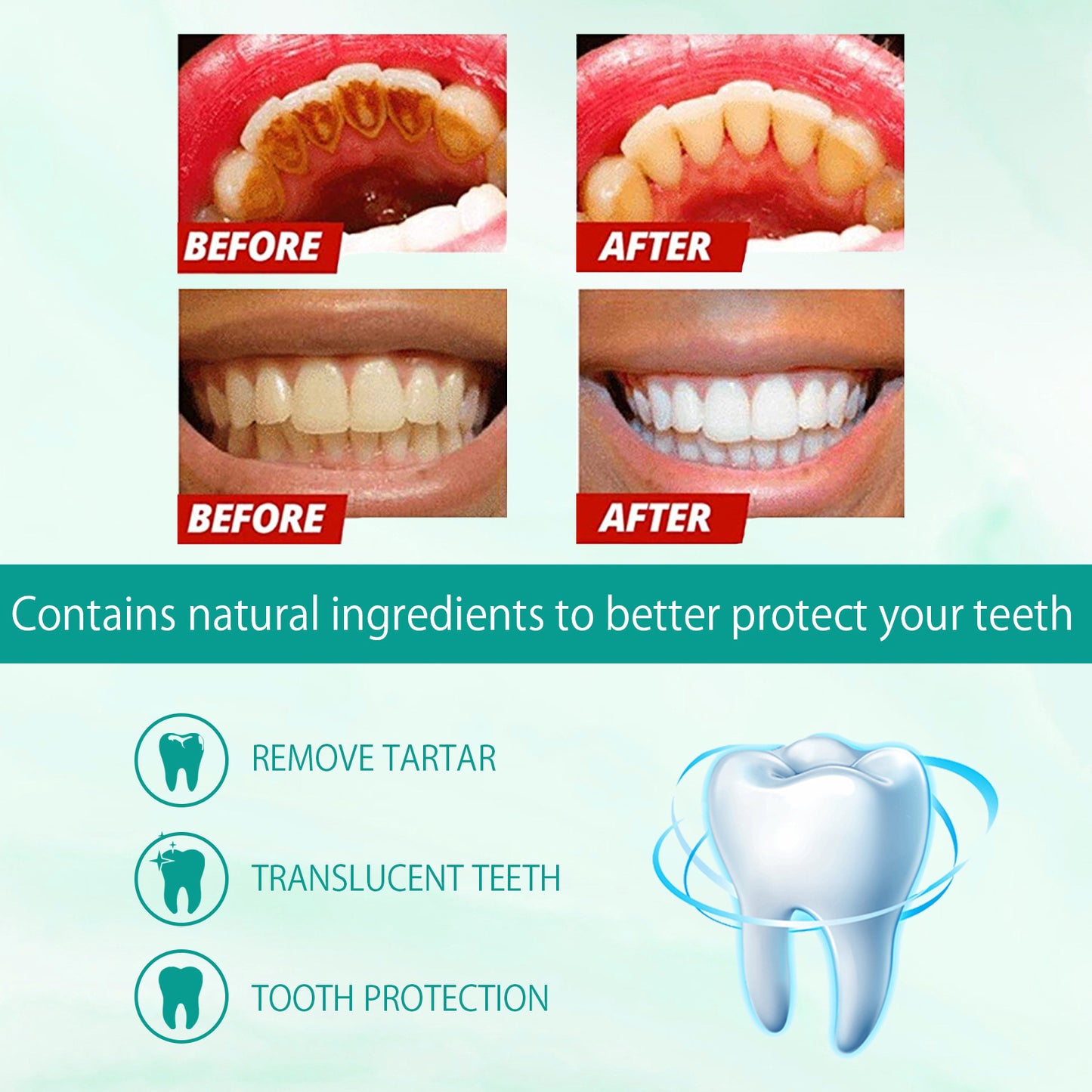 Whitening Toothpaste for Stain Removal & Gum Care - 50g