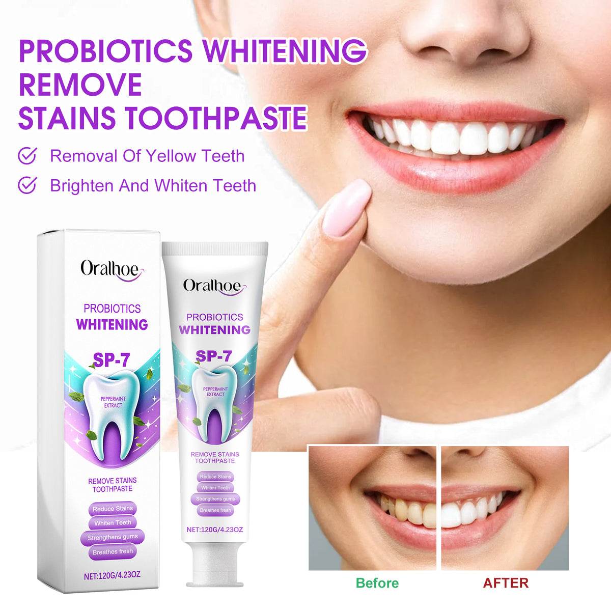 Probiotic Whitening Toothpaste 120g - Dental Care for Stain Removal & Fresh Breath