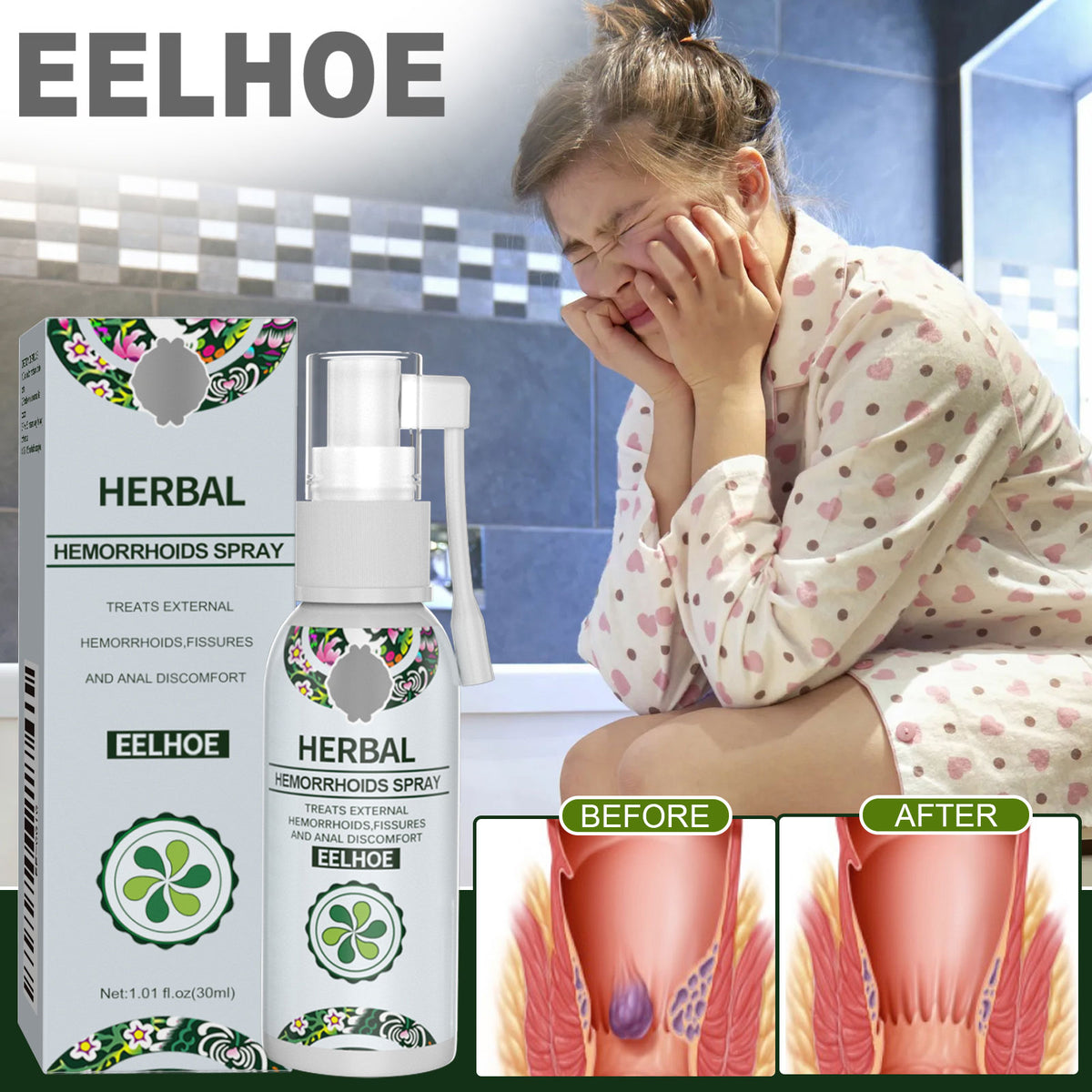 Herbal Perianal Care Spray – 30ml