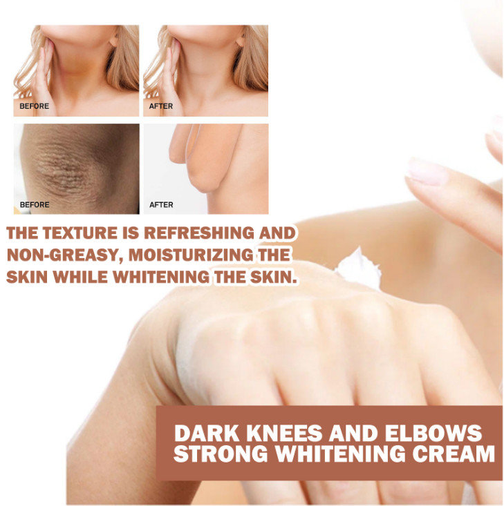 Joint Brightening Cream for Elbows and Knees - Dark Spot Corrector