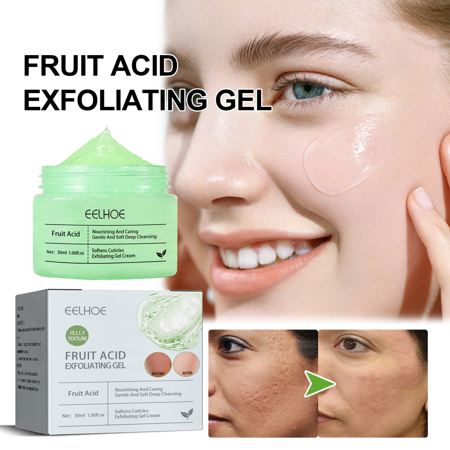 Hydroxy Acid Facial Exfoliating Gel - Deep Pore Cleansing & Skin Brightening