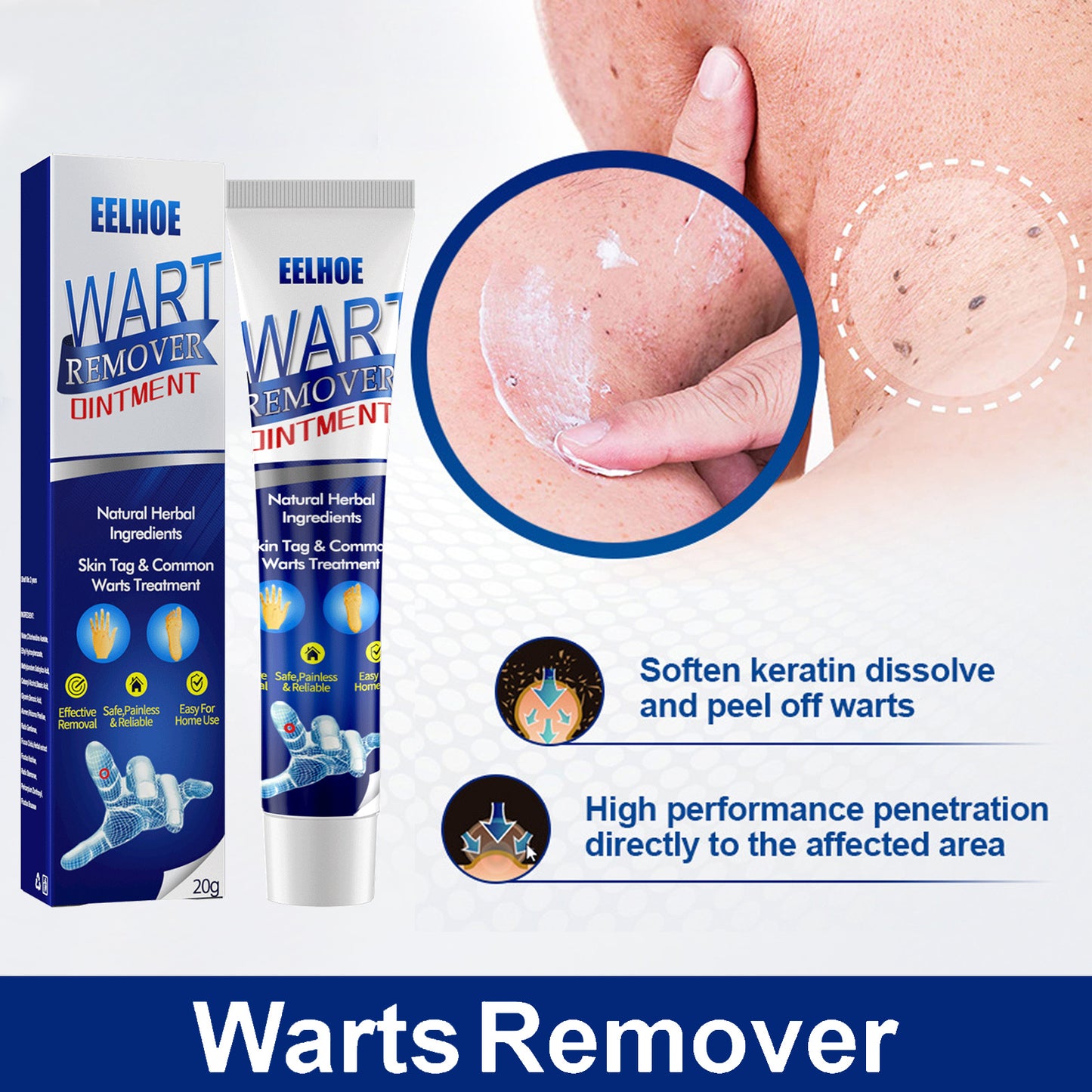 Skin Smoothing & Rejuvenating Body Cream for Wart and Spot Removal