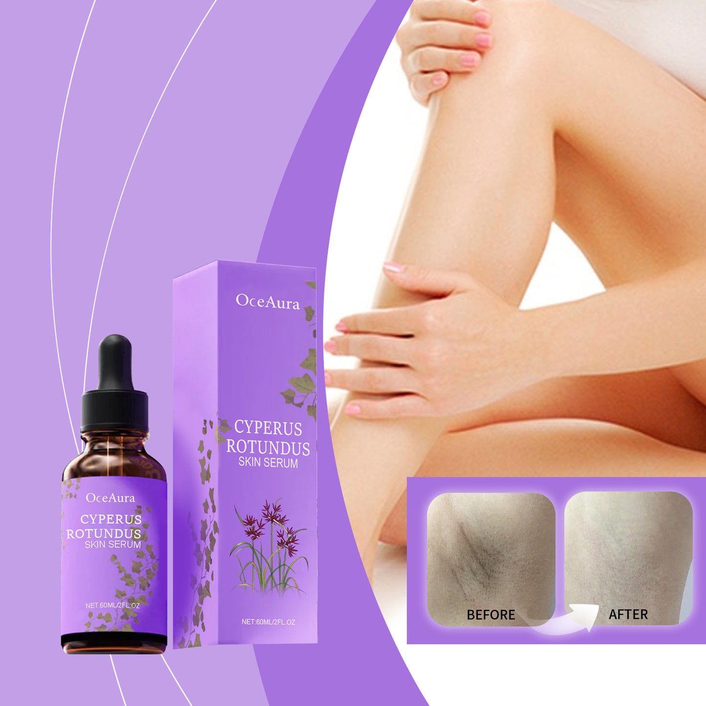 Post Hair Removal Repair Essence - 60ml Soothing Skin Care Serum